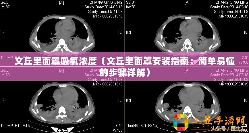 文丘里面罩吸氧濃度（文丘里面罩安裝指南：簡單易懂的步驟詳解）