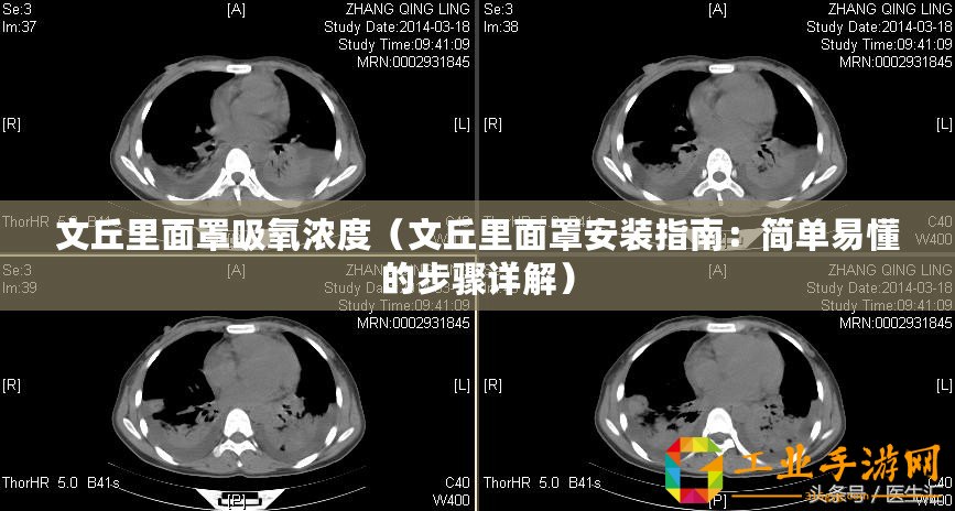 文丘里面罩吸氧濃度（文丘里面罩安裝指南：簡單易懂的步驟詳解）